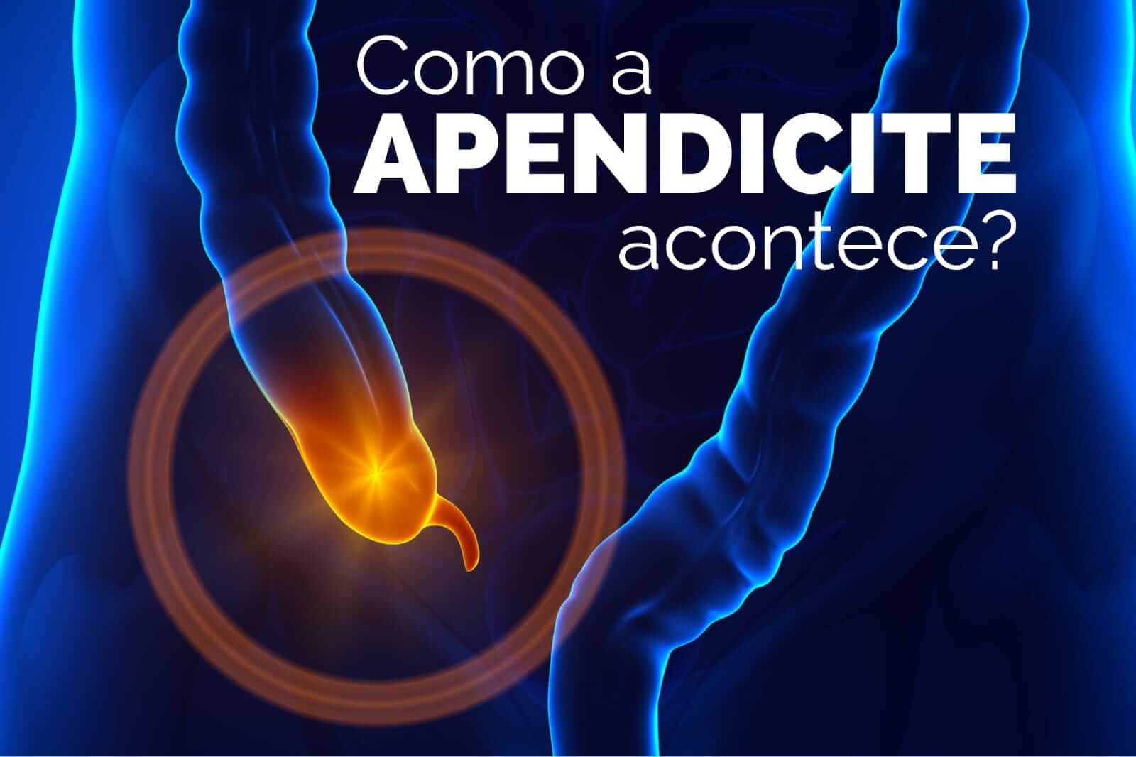 Como a apendicite acontece?