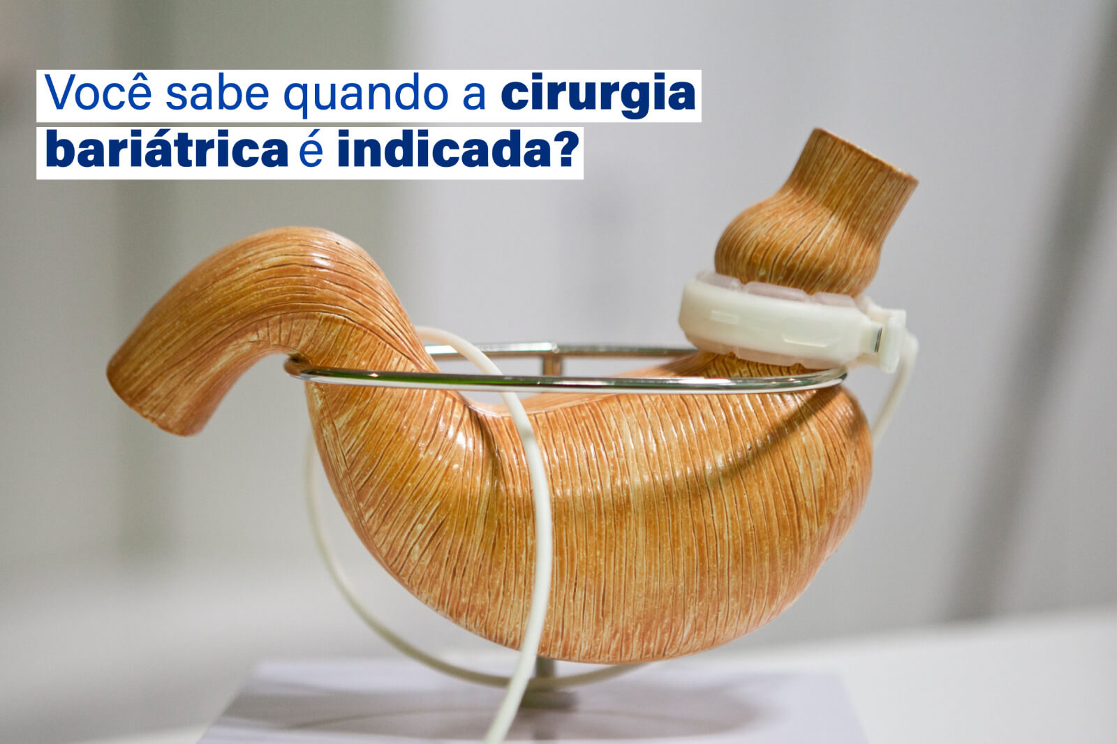 Você sabe quando a cirurgia bariátrica é indicada?