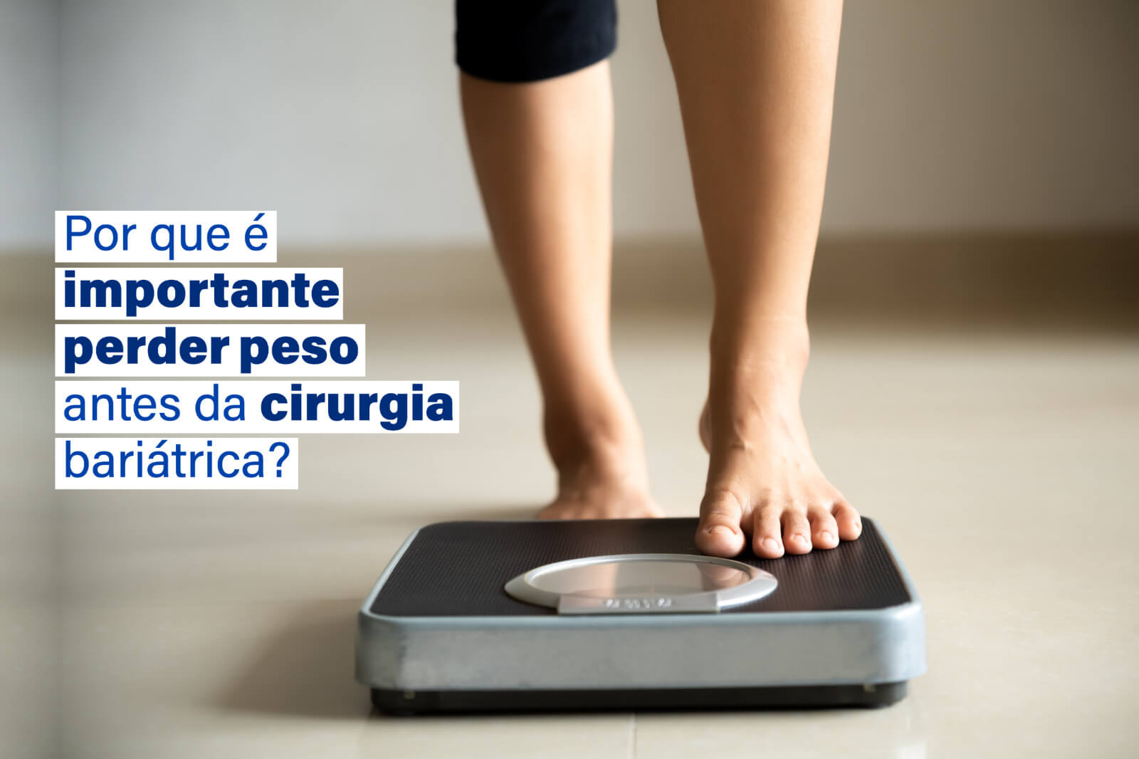 Por que é importante perder peso antes da cirurgia bariátrica?