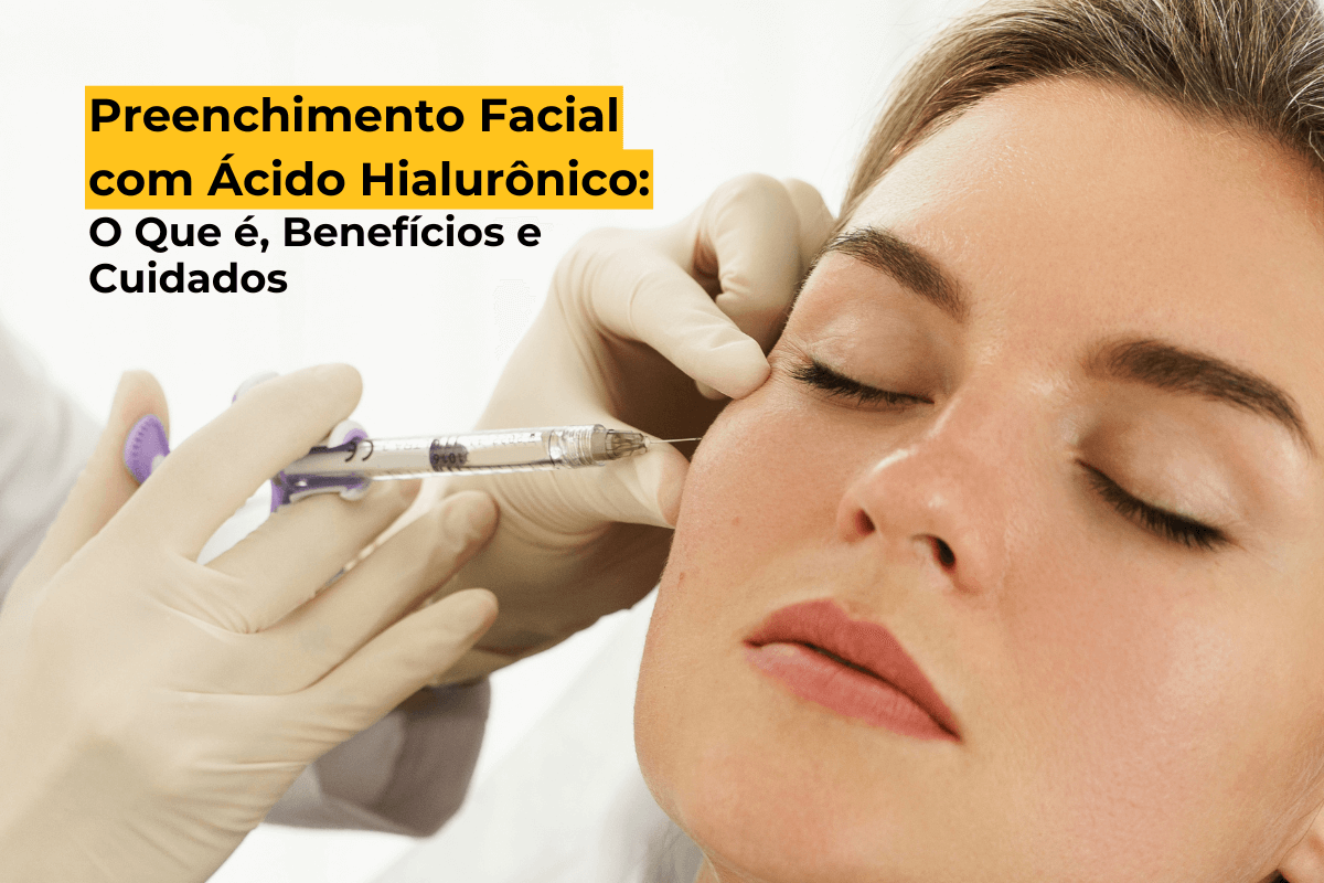 Preenchimento Facial com Ácido Hialurônico em Maringá: O Que é, Benefícios e Cuidados