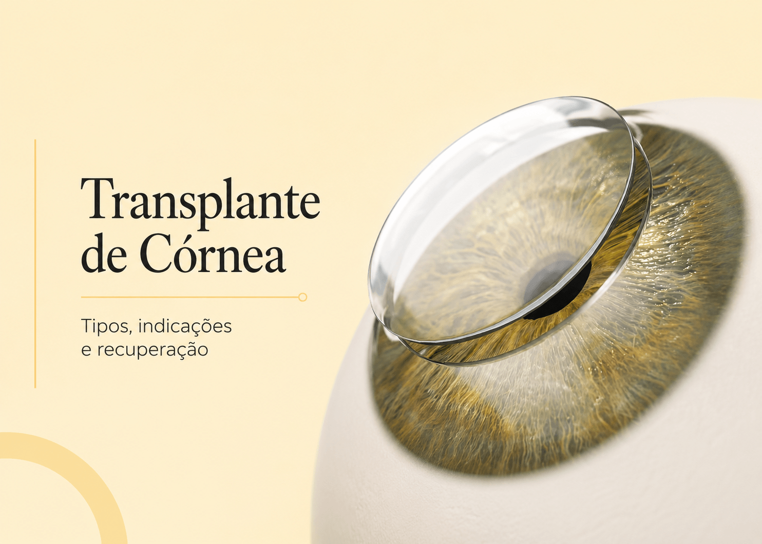 Transplante de Córnea em Maringá: tipos, indicações e recuperação