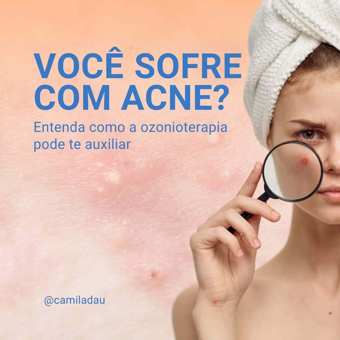 Você Sofre com Acne?