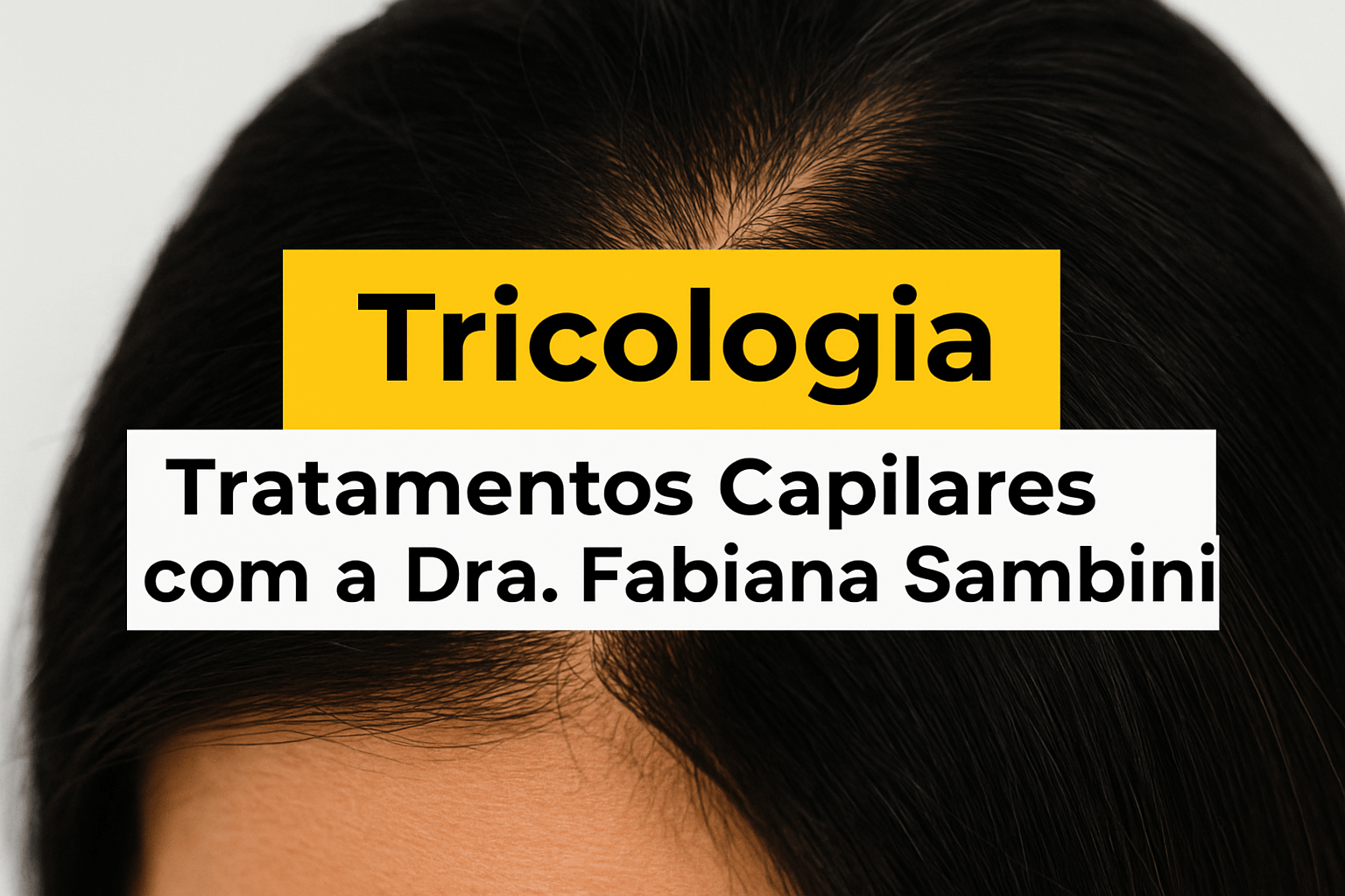 Tricologia em Nova Esperança: Solução Médica para Tratamentos Capilares