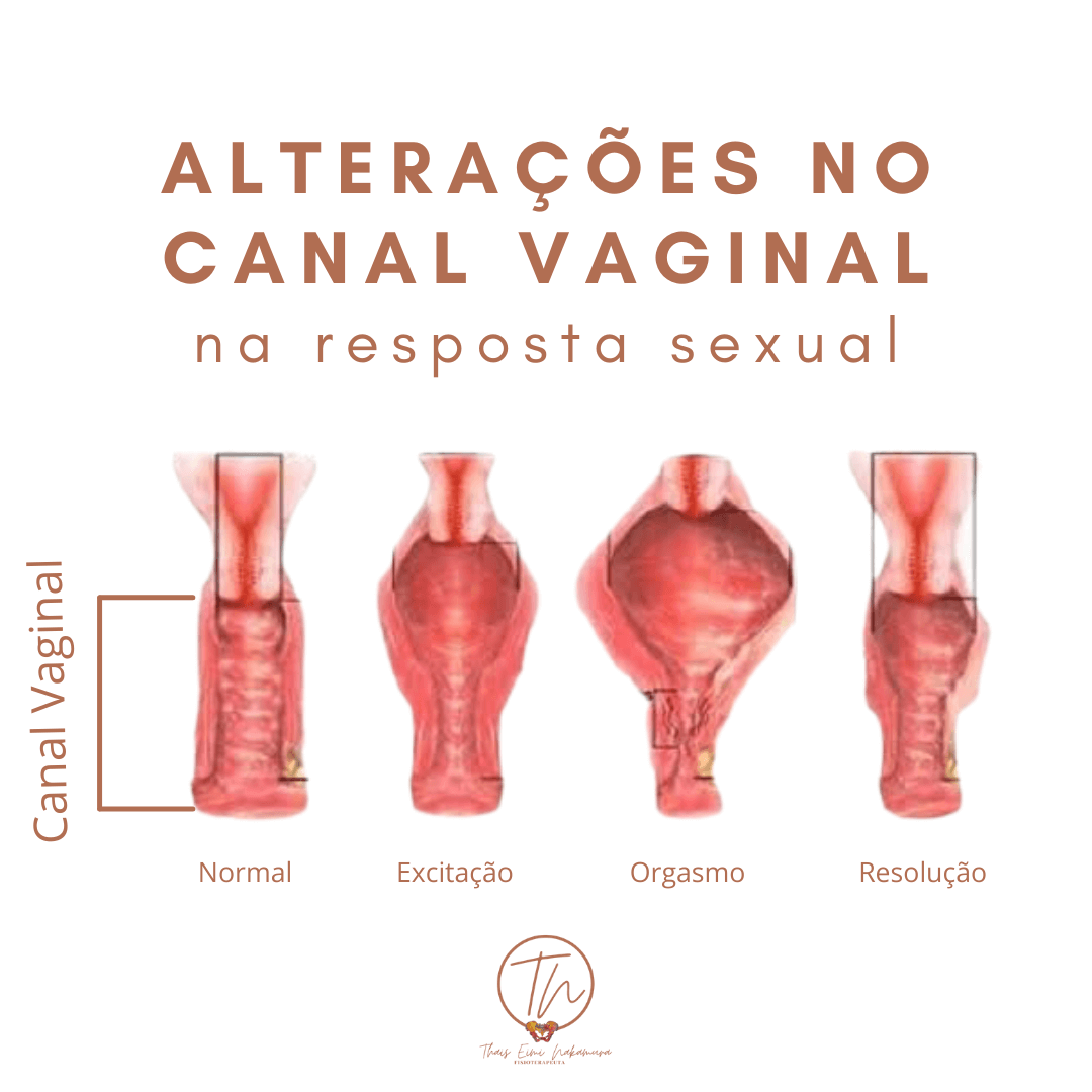 Alterações no canal vaginal na resposta sexual