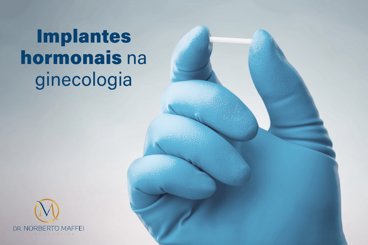 Implantes hormonais na ginecologia