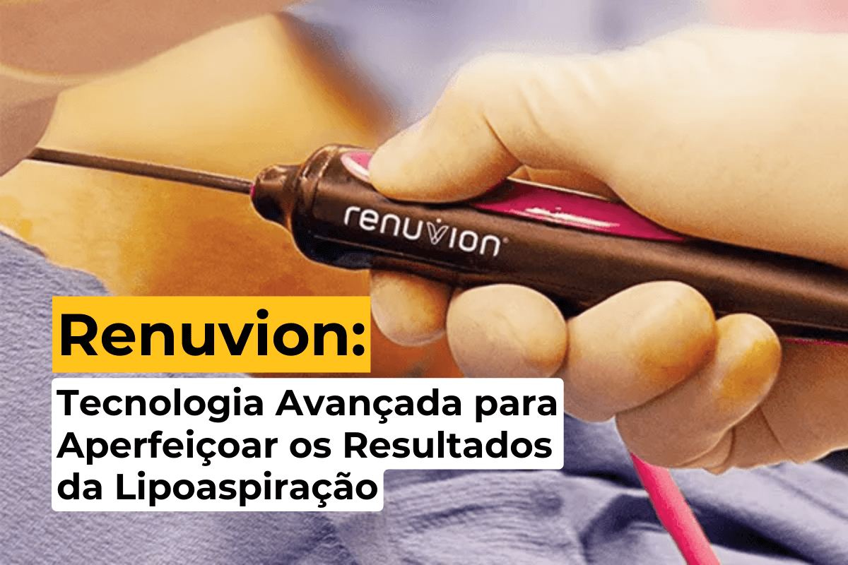 Renuvion em Uberlândia: Tecnologia Avançada para Aperfeiçoar os Resultados da Lipoaspiração