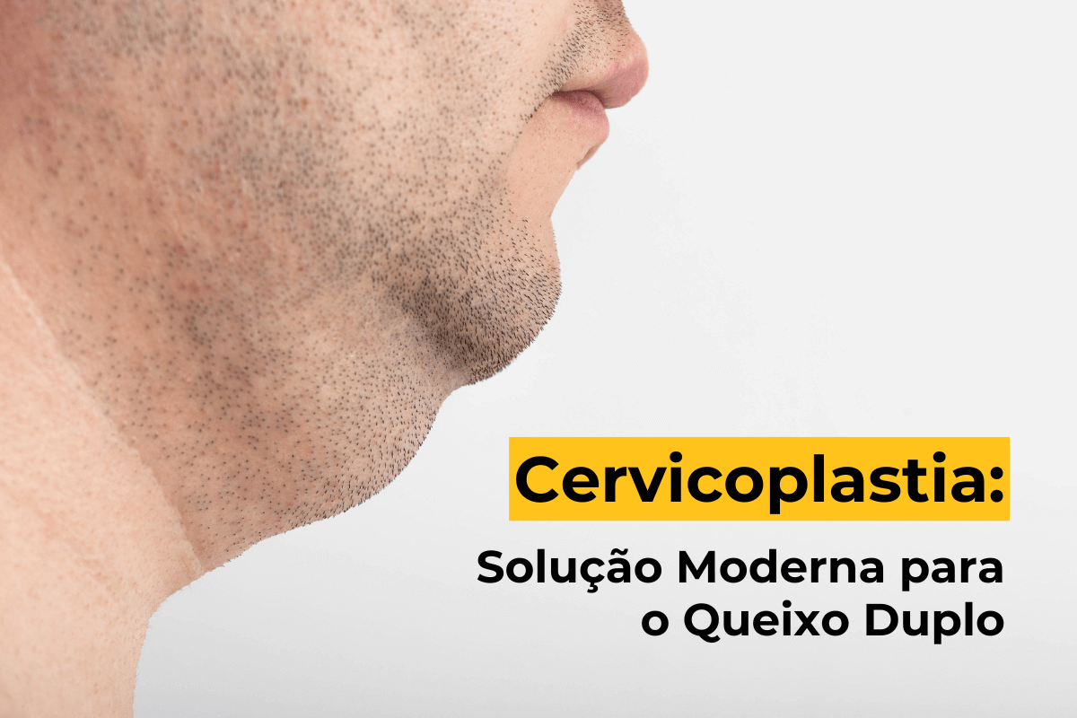 Cervicoplastia em Maringá: Solução Moderna para o Queixo Duplo
