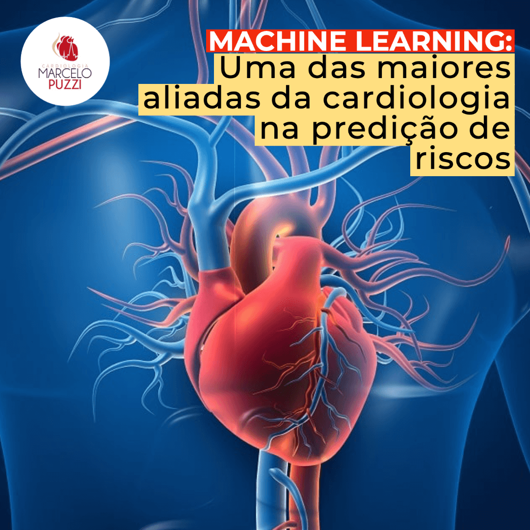 Machine learning: Uma das maiores aliadas da cardiologia na predição de riscos