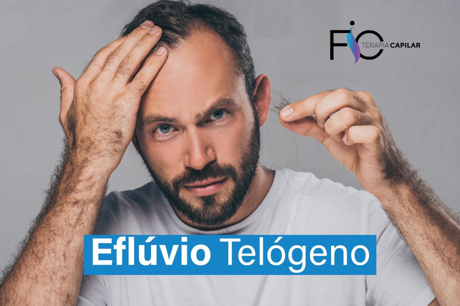 Eflúvio Telógeno