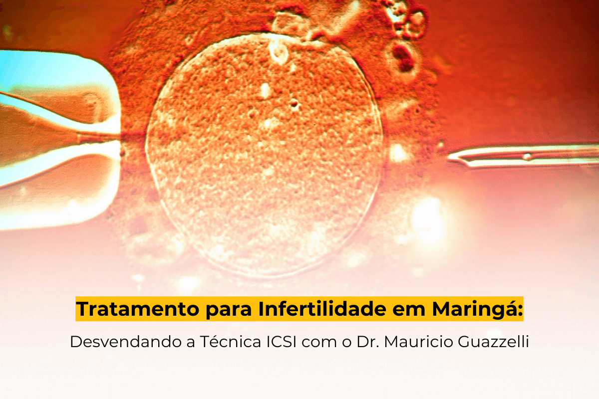 Tratamento para Infertilidade em Maringá: Desvendando a Técnica ICSI com o Dr. Mauricio Guazzelli