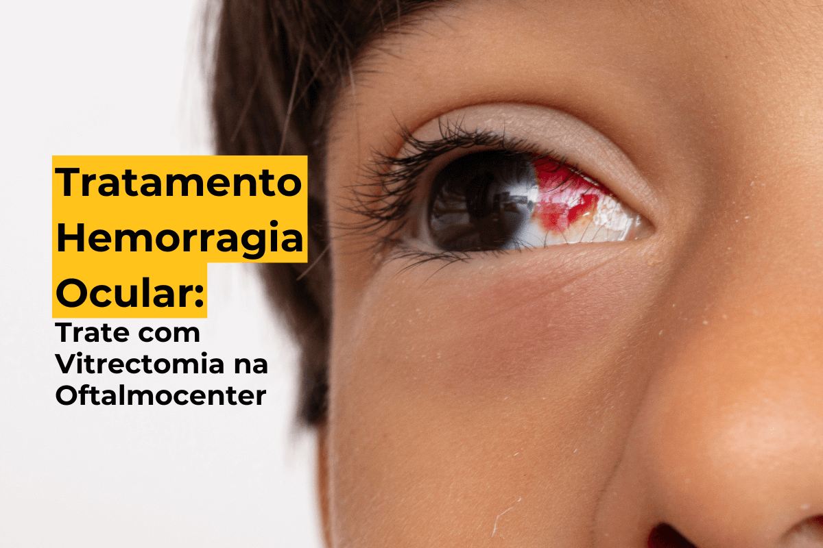 Tratamento Hemorragia Ocular em Maringá: Trate com Vitrectomia na Oftalmocenter