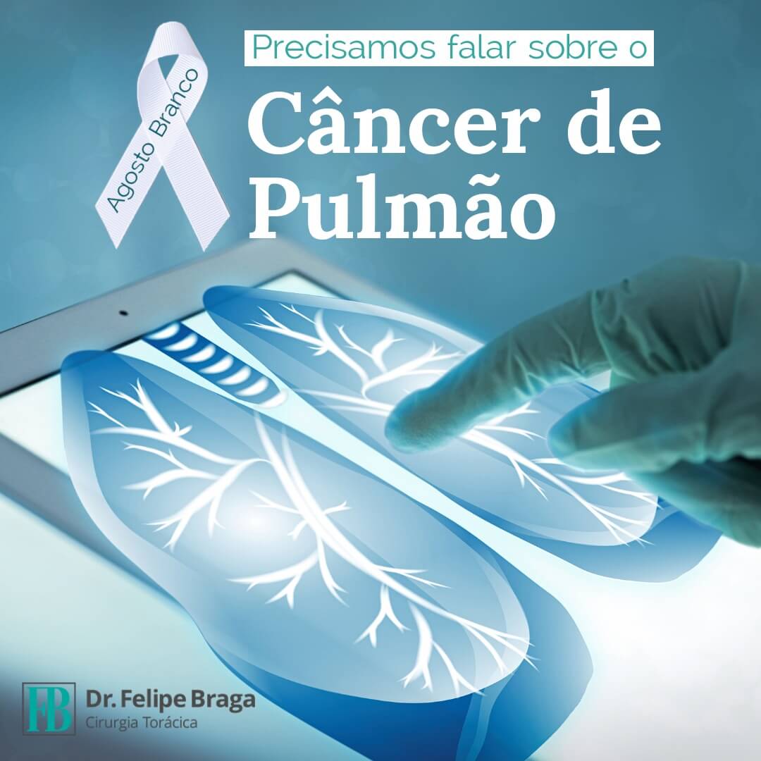 Precisamos falar sobre o câncer de pulmão