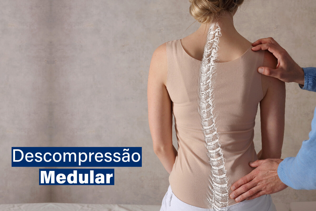 Descompressão Medular