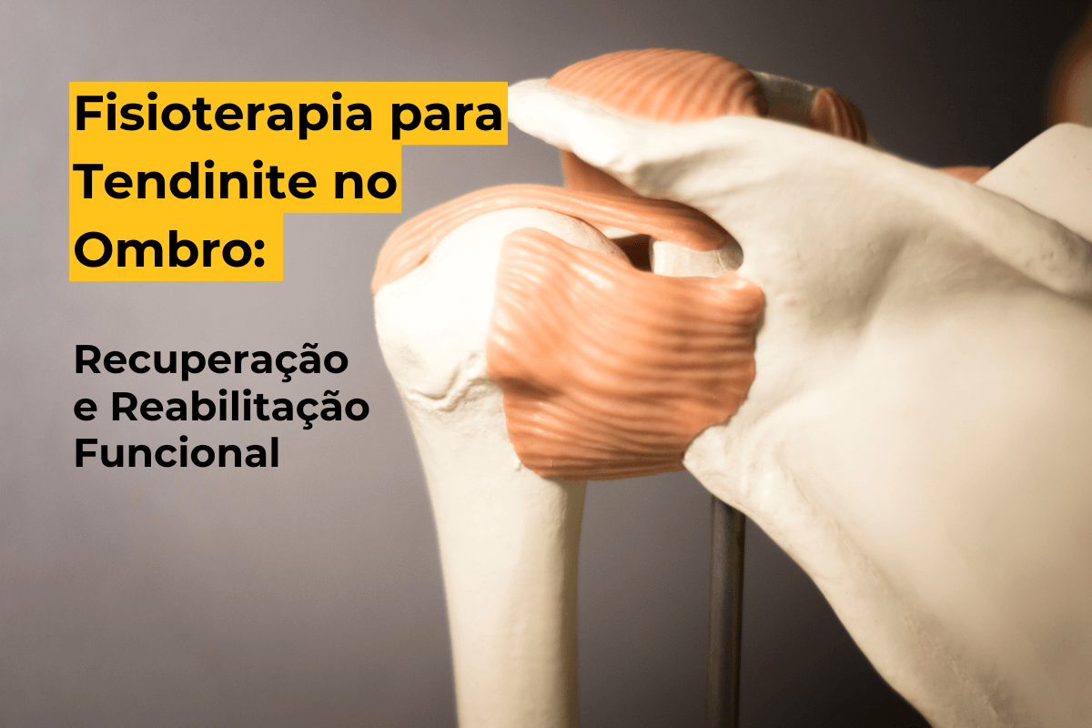 Fisioterapia para Tendinite no Ombro em Maringá: Recuperação e Reabilitação Funcional