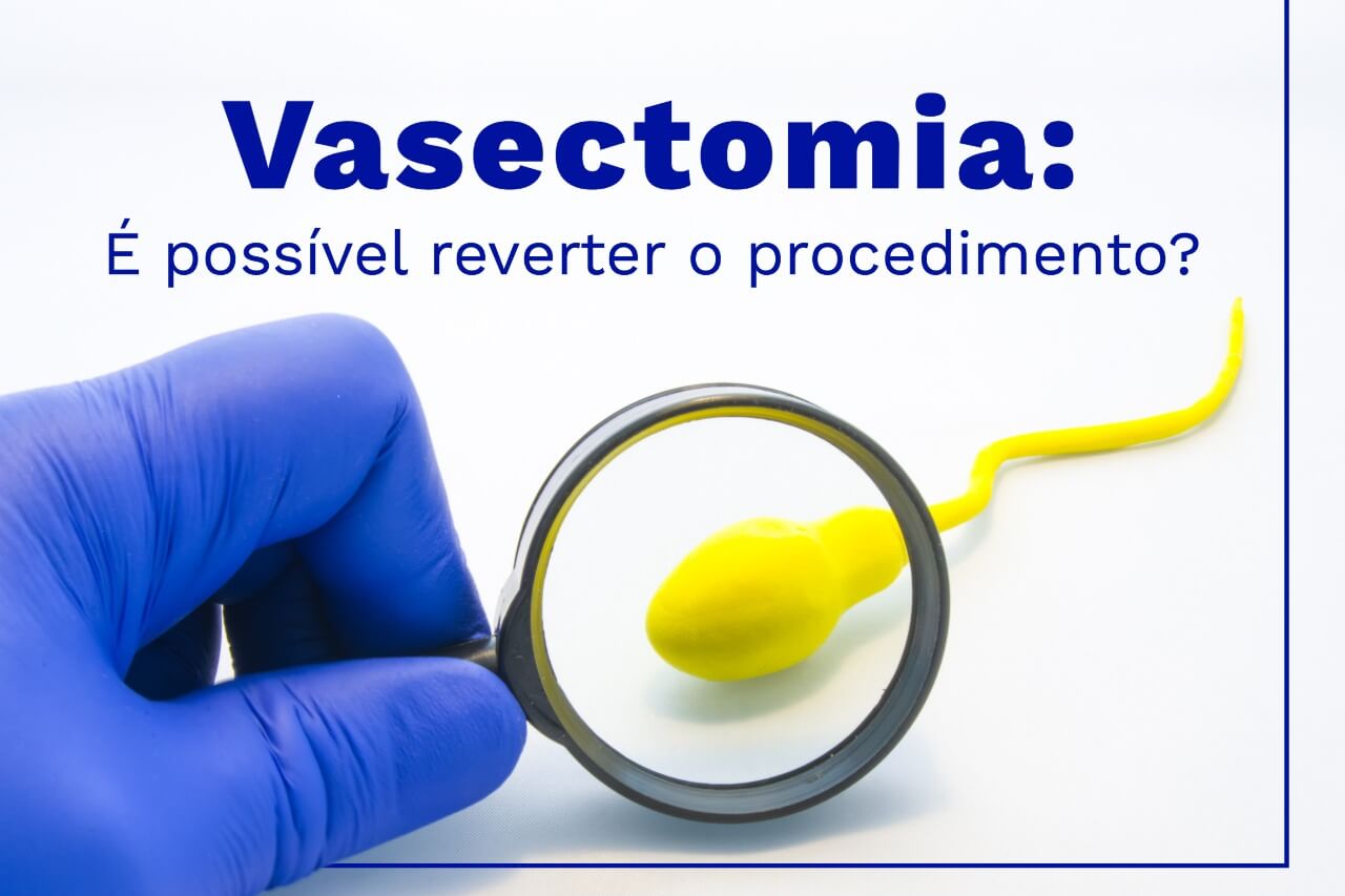 Vasectomia: É possível reverter o procedimento?