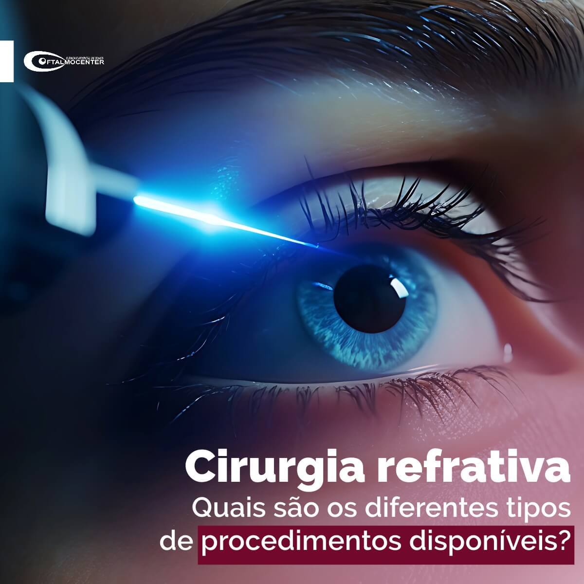 Cirurgia refrativa: Quais são os diferentes tipos de procedimentos disponíveis?