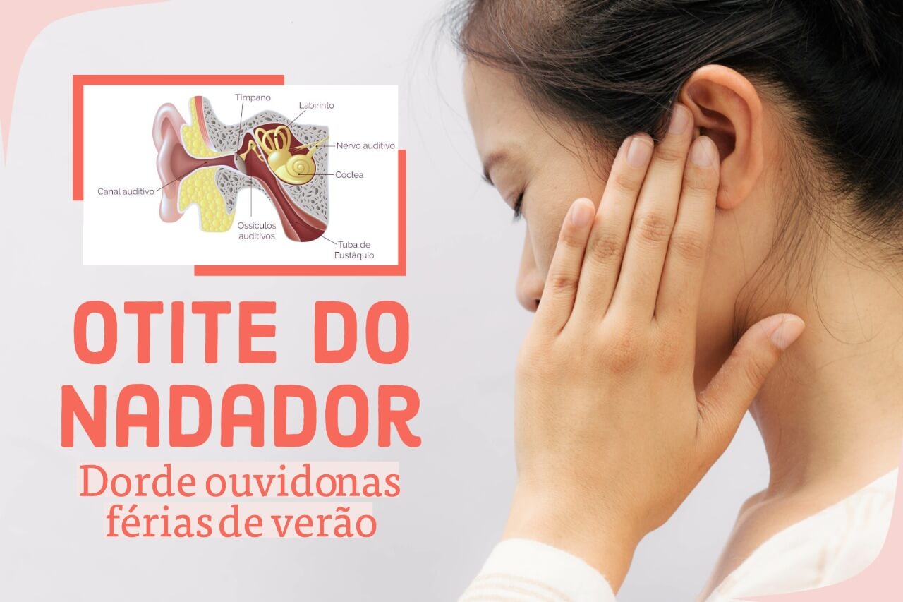 Otite do nadador – dor de ouvido nas férias de verão