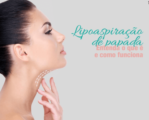 23-02-2022-1645642159fb5c81ed3a220004b71069645f112867.png