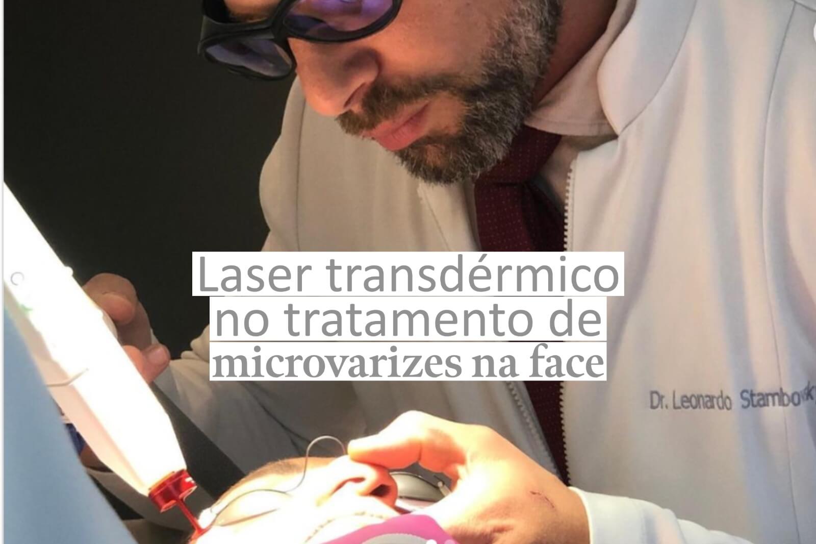 Laser transdérmico no tratamento de microvarizes na face