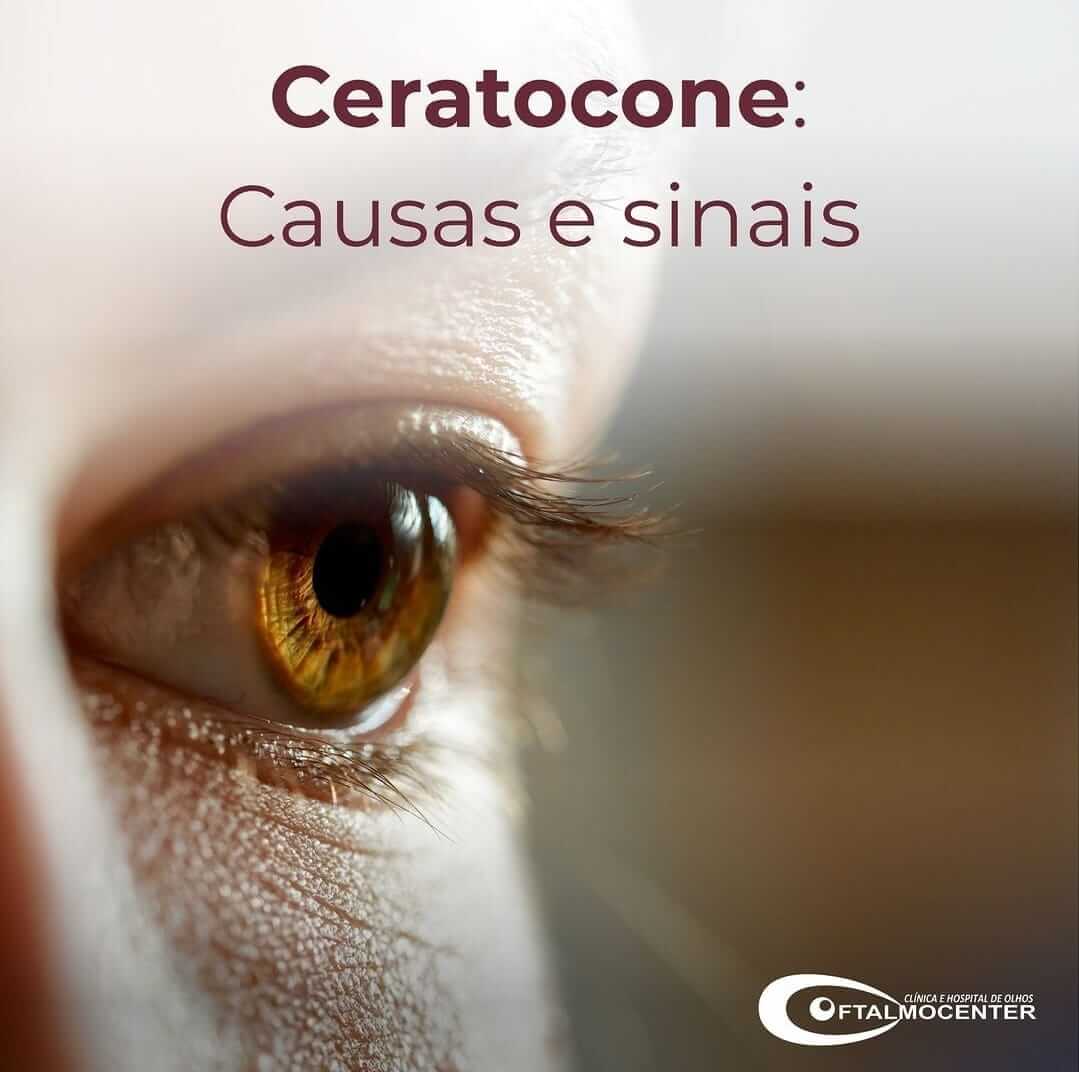 Ceratocone: Causas e Sinais