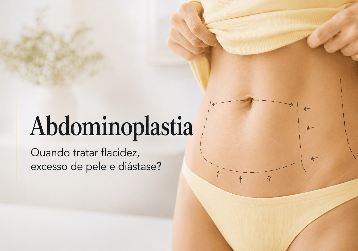 Abdominoplastia em Uberlândia: quando tratar flacidez, excesso de pele e diástase?