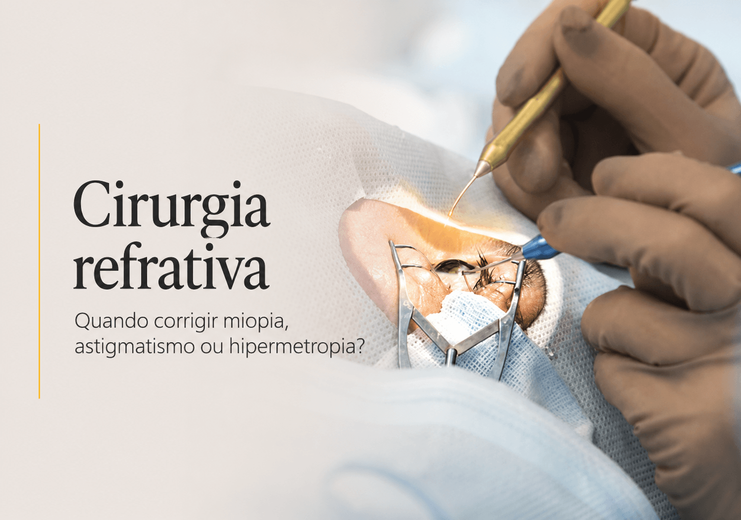 Cirurgia refrativa em Maringá: quando corrigir miopia, astigmatismo ou hipermetropia?