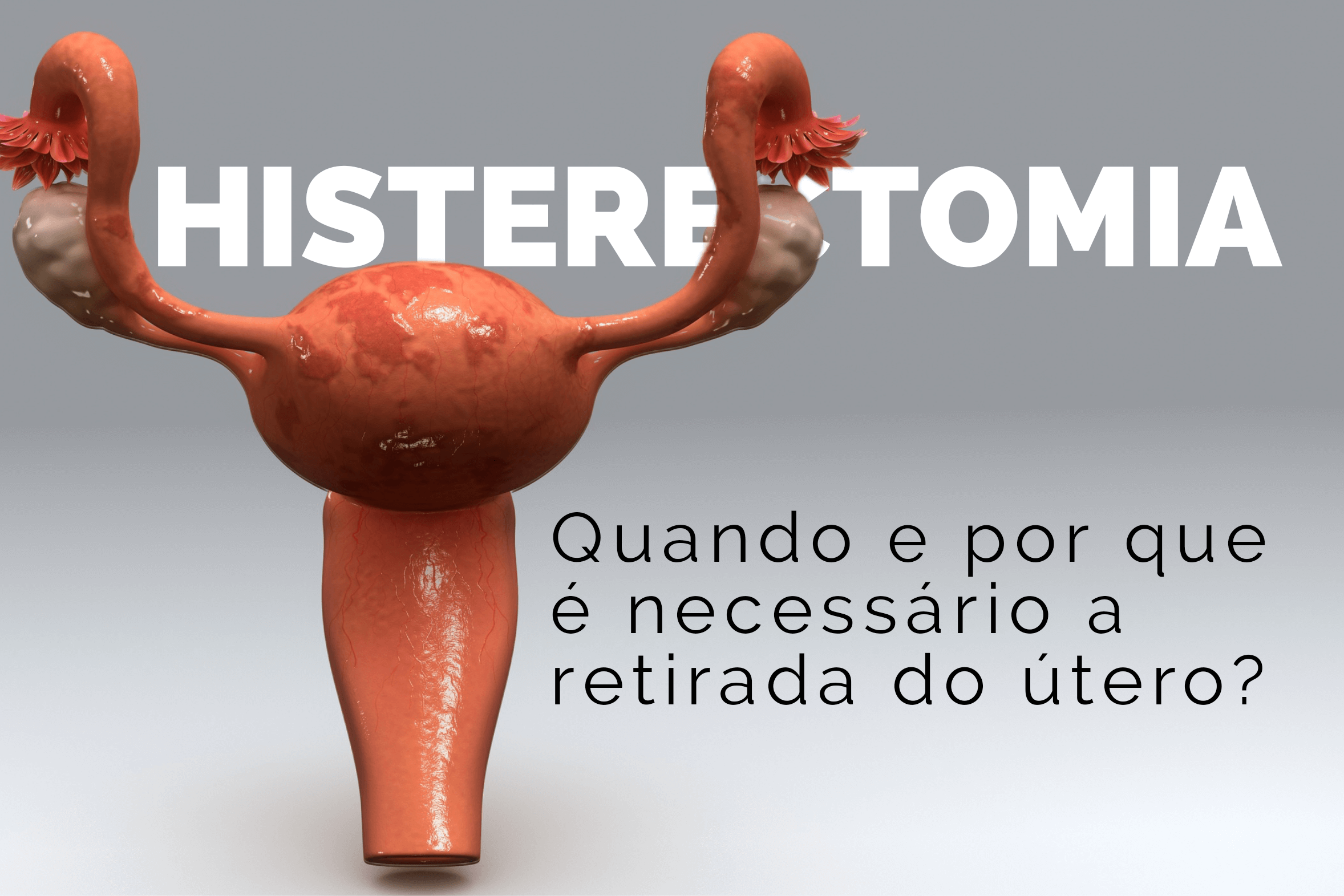 Histerectomia: Quando e por que é necessário a retirada do útero?