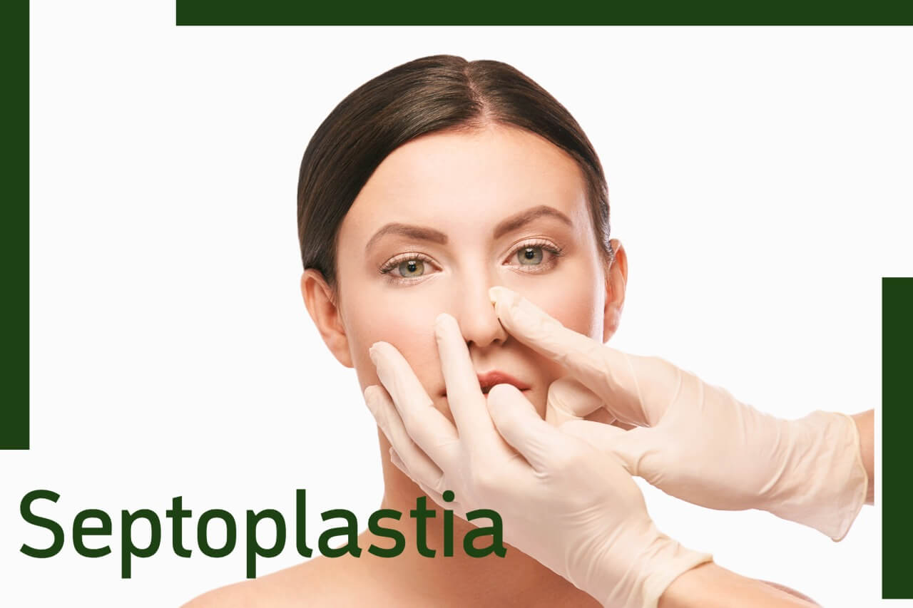 Septoplastia