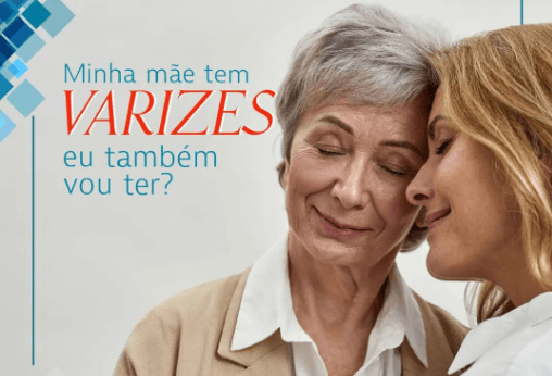 Minha mãe tem varizes, eu também vou ter?