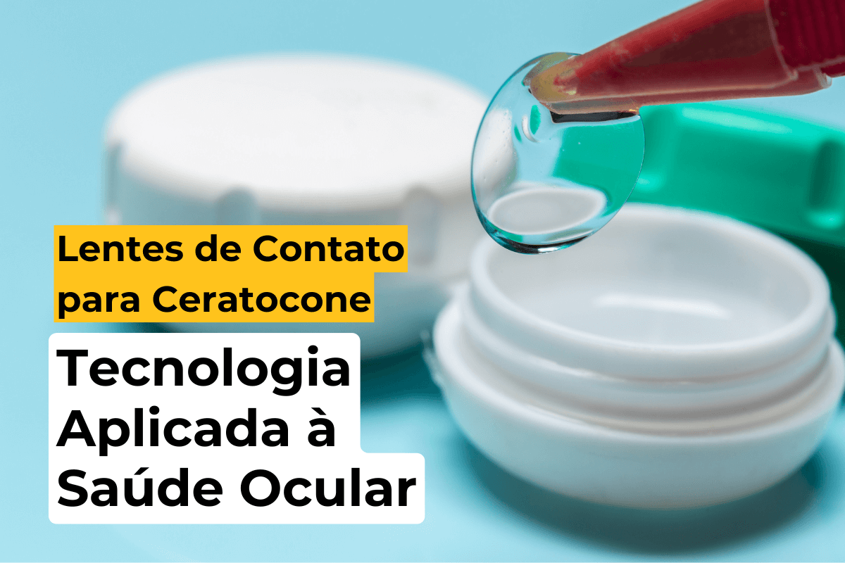Lentes de Contato para Ceratocone em Maringá: Tecnologia Aplicada à Saúde Ocular