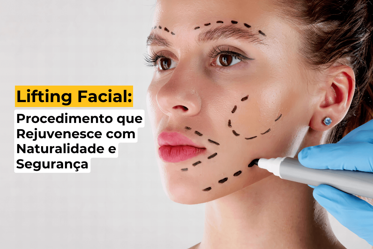 Lifting Facial em Uberlândia: Procedimento que Rejuvenesce com Naturalidade e Segurança