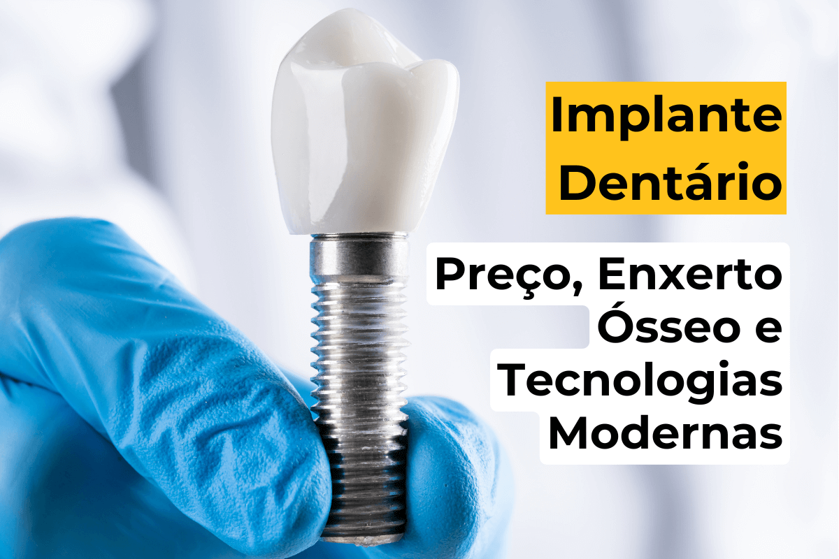 Implante Dentário em Maringá: Preço, Enxerto Ósseo e Tecnologias Modernas