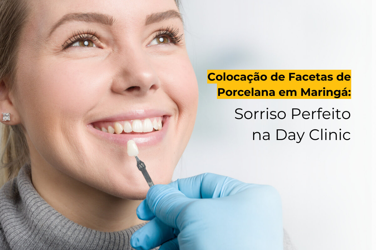 Colocação de Facetas de Porcelana em Maringá: Sorriso Perfeito na Day Clinic