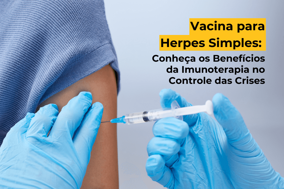 Vacina para Herpes Simples Maringá: Conheça os Benefícios da Imunoterapia no Controle das Crises