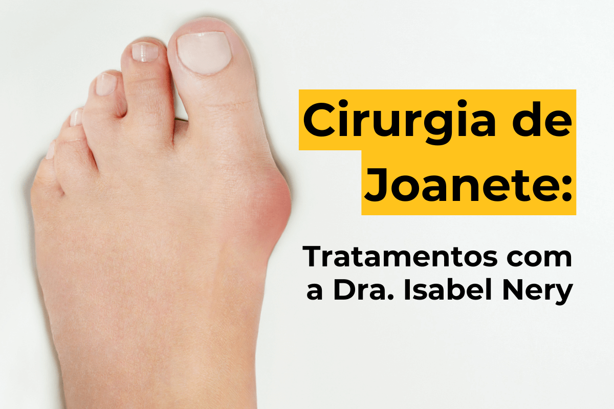 Cirurgia de Joanete em Curitiba: Tratamentos com a Dra. Isabel Nery