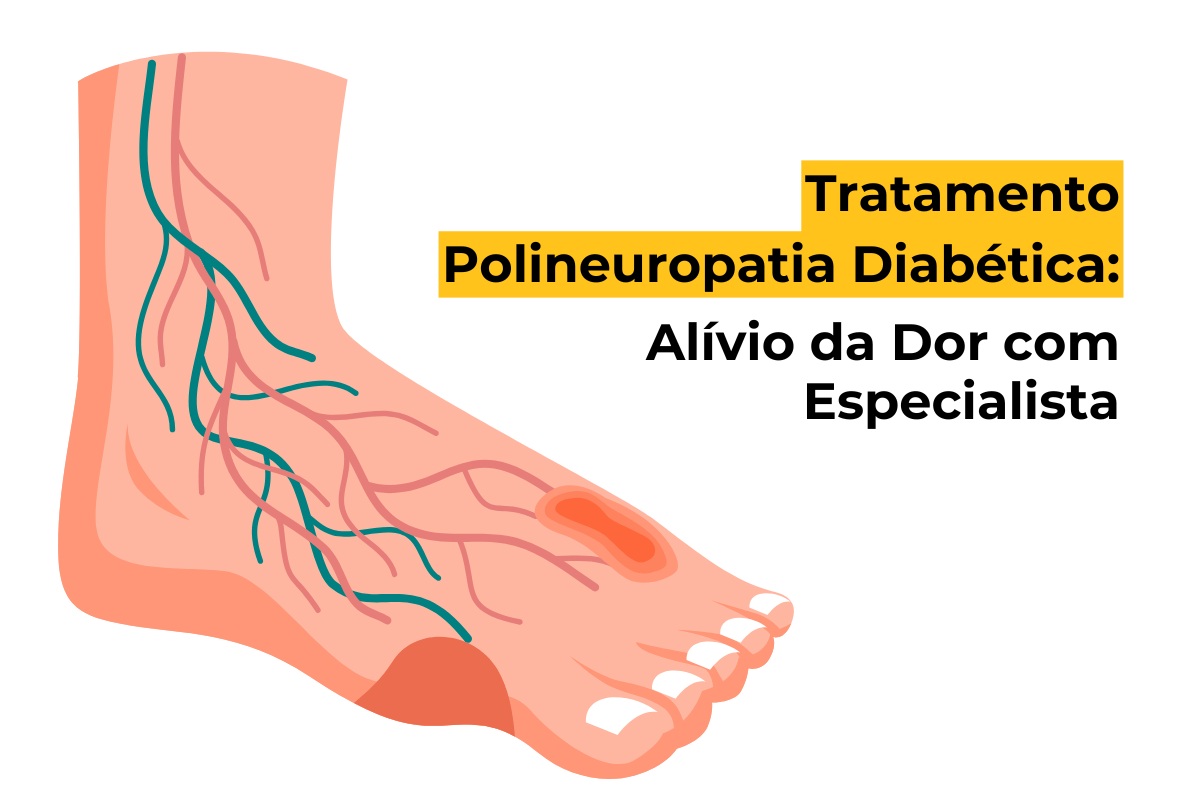 Tratamento Polineuropatia Diabética em Maringá: Alívio da Dor com Especialista