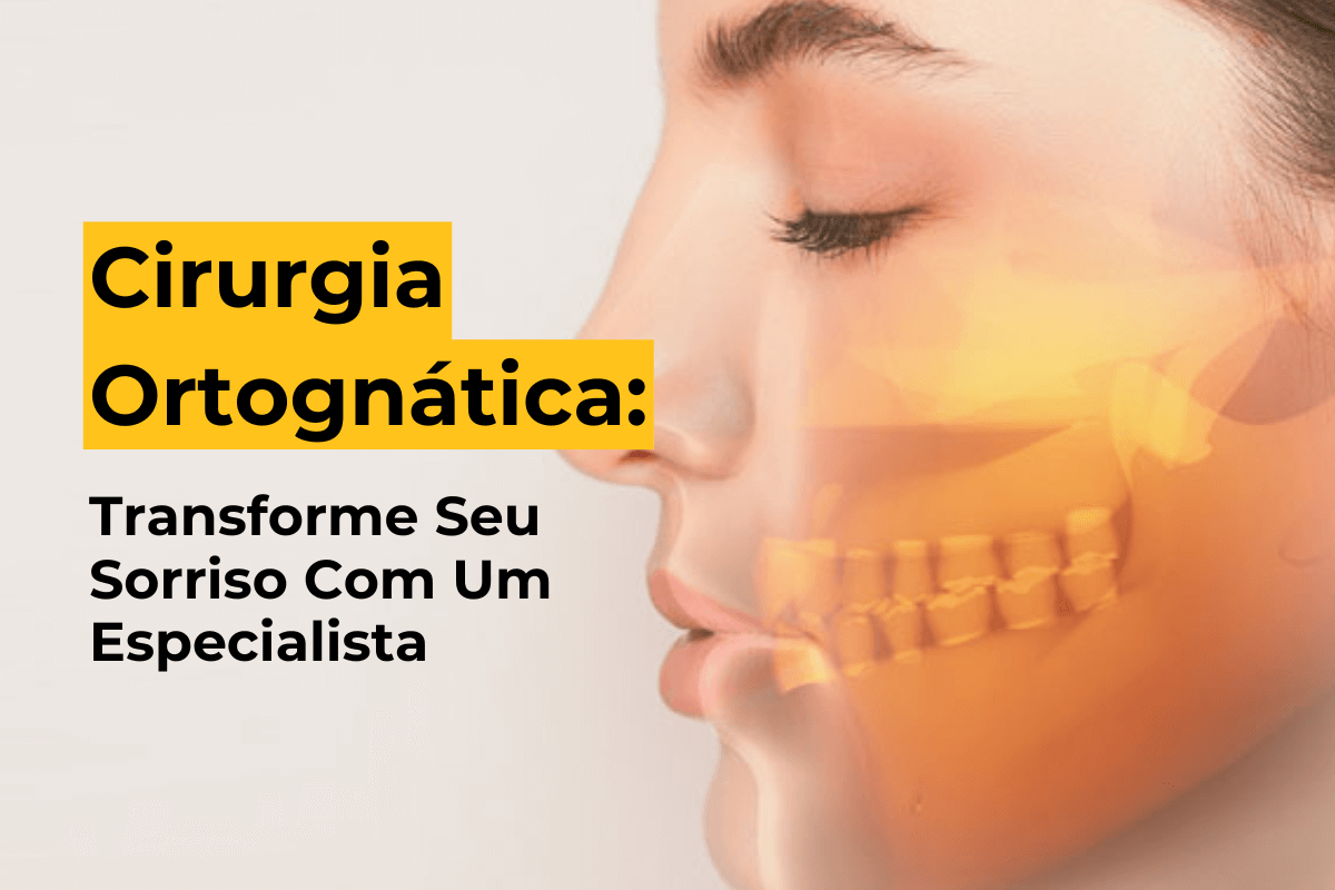 Cirurgia Ortognática Maringá: Transforme Seu Sorriso Com Um Especialista
