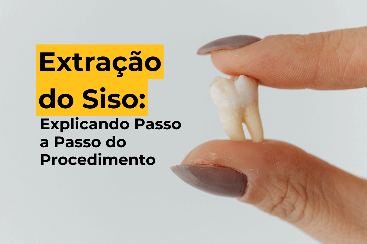 Extração do Siso em Maringá: Explicando Passo a Passo do Procedimento