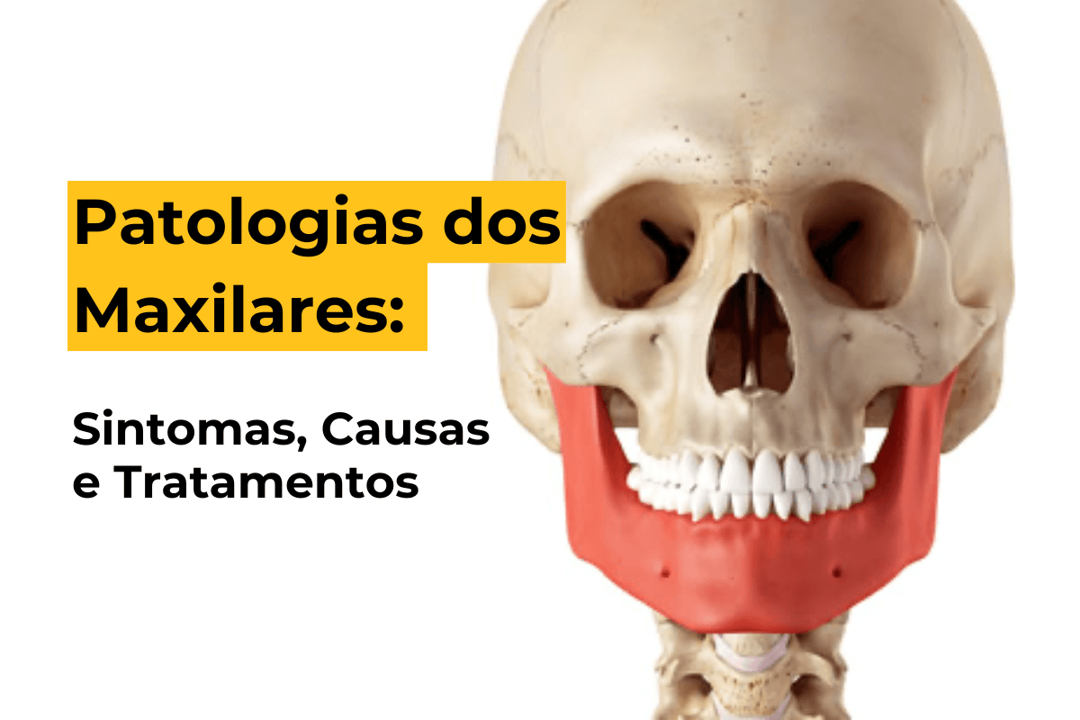 Patologias dos Maxilares em Maringá: Sintomas, Causas e Tratamentos