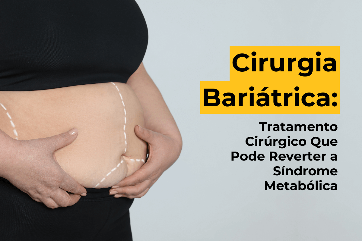 Cirurgia Bariátrica Metabólica em Maringá: Tratamento Cirúrgico Que Pode Reverter a Síndrome Metabólica