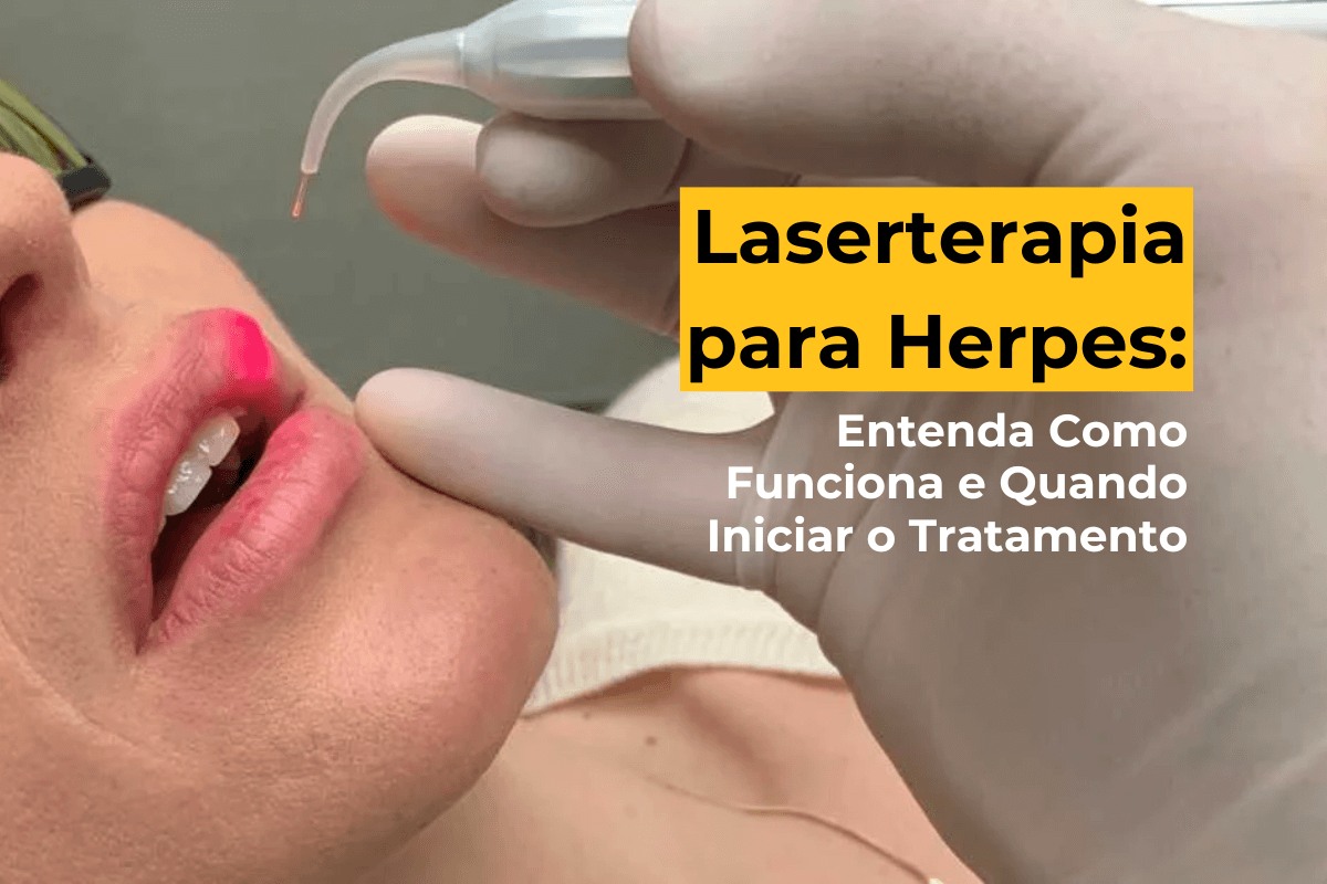 Laserterapia para Herpes em Maringá: Entenda Como Funciona e Quando Iniciar o Tratamento