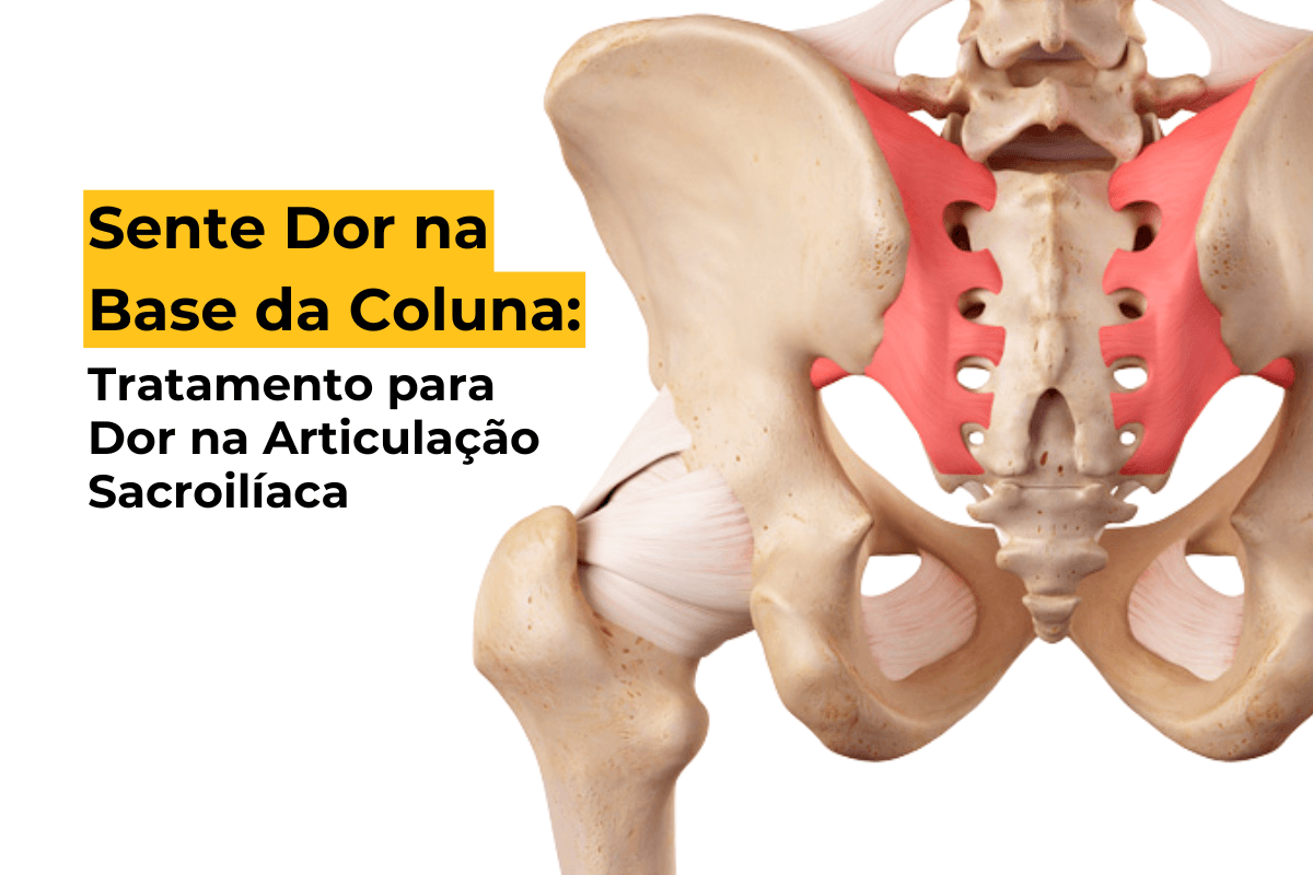 Sente Dor na Base da Coluna: Tratamento em Maringá para Dor na Articulação Sacroilíaca