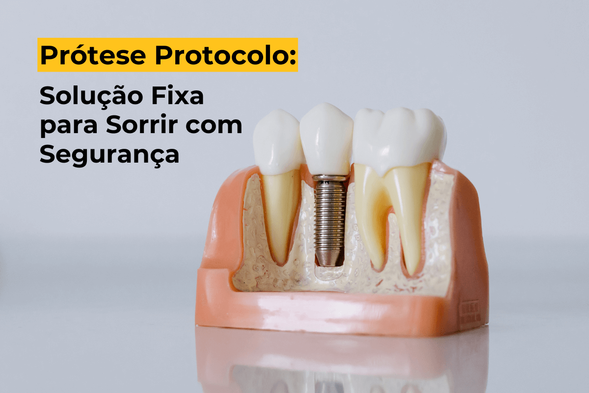 Prótese Protocolo em Maringá: Solução Fixa para Sorrir com Segurança