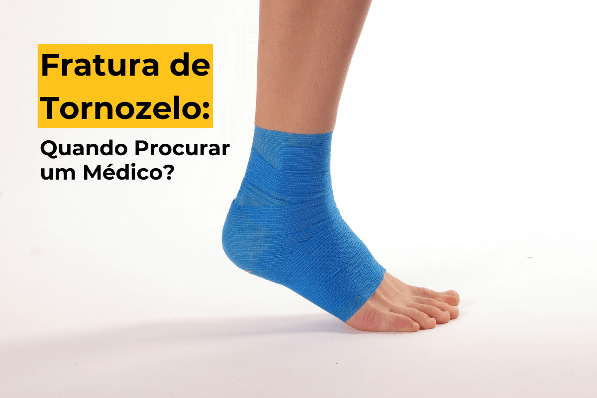 Fratura de Tornozelo em Curitiba: Quando Procurar um Médico?
