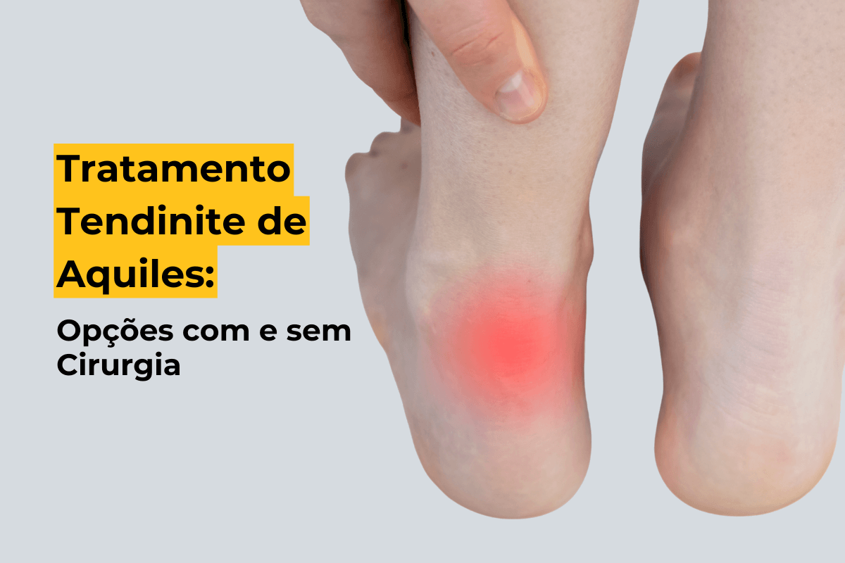 Tratamento Tendinite de Aquiles em Curitiba: Opções com e sem Cirurgia