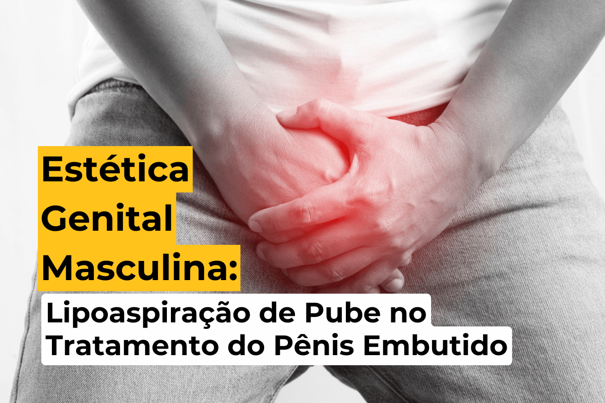 Estética Genital Masculina em Maringá: Lipoaspiração de Pube no Tratamento do Pênis Embutido