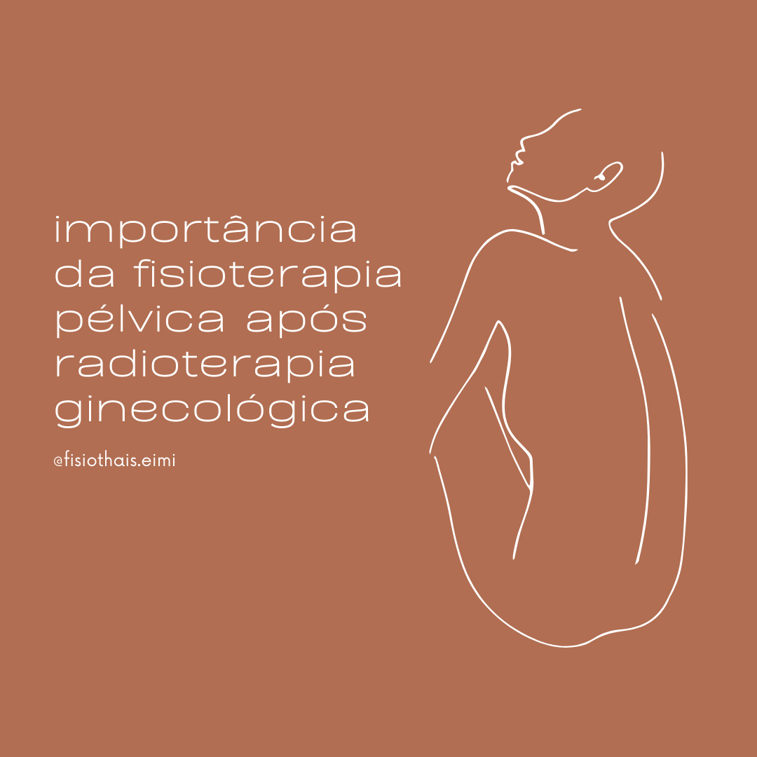 Importância da fisioterapia pélvica após radioterapia uroginecológica e coloproctológica