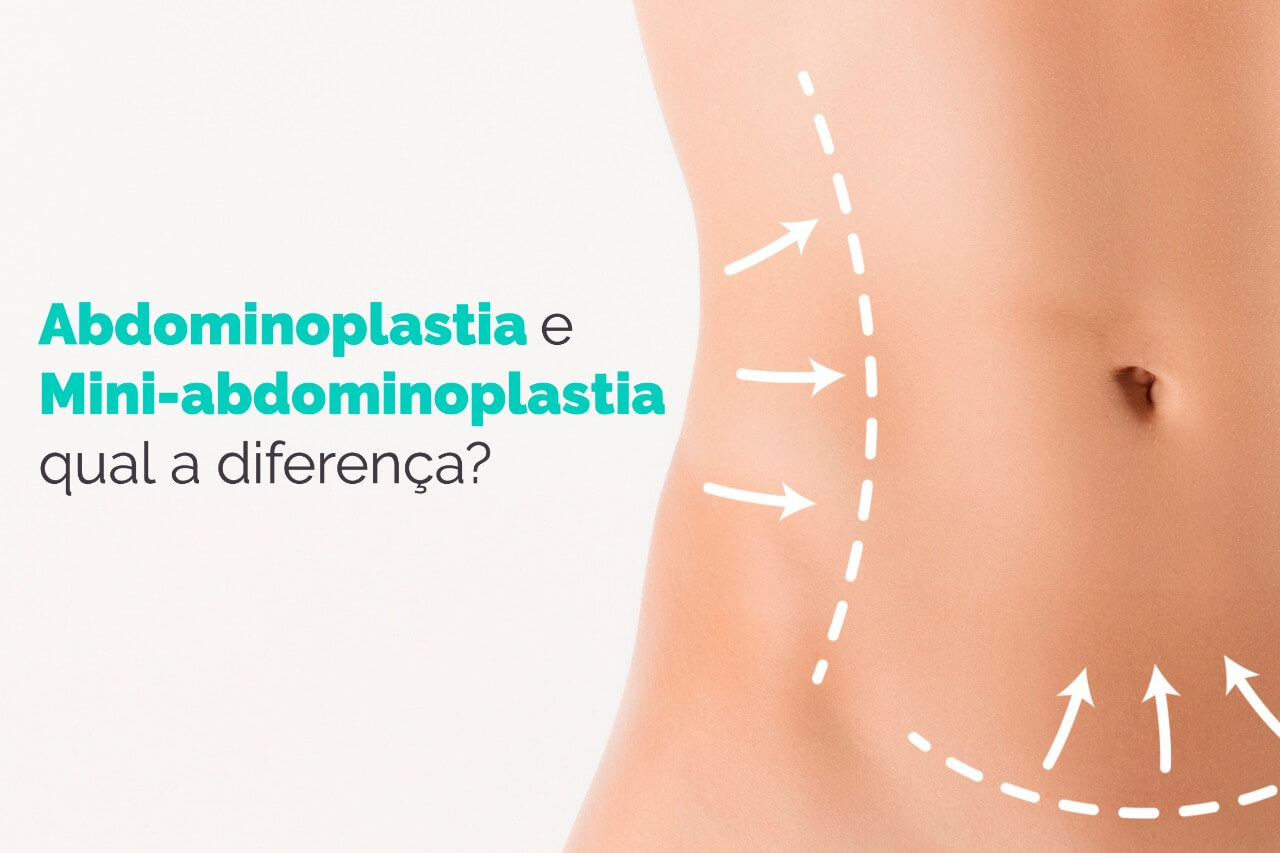 Abdominoplastia e Mini-abdominoplastia qual a diferença?