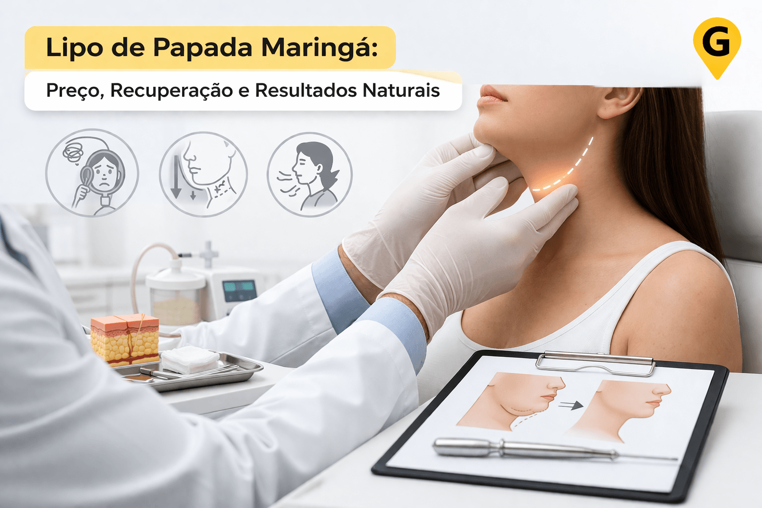 Lipo de Papada Maringá: Preço, Recuperação e Resultados Naturais