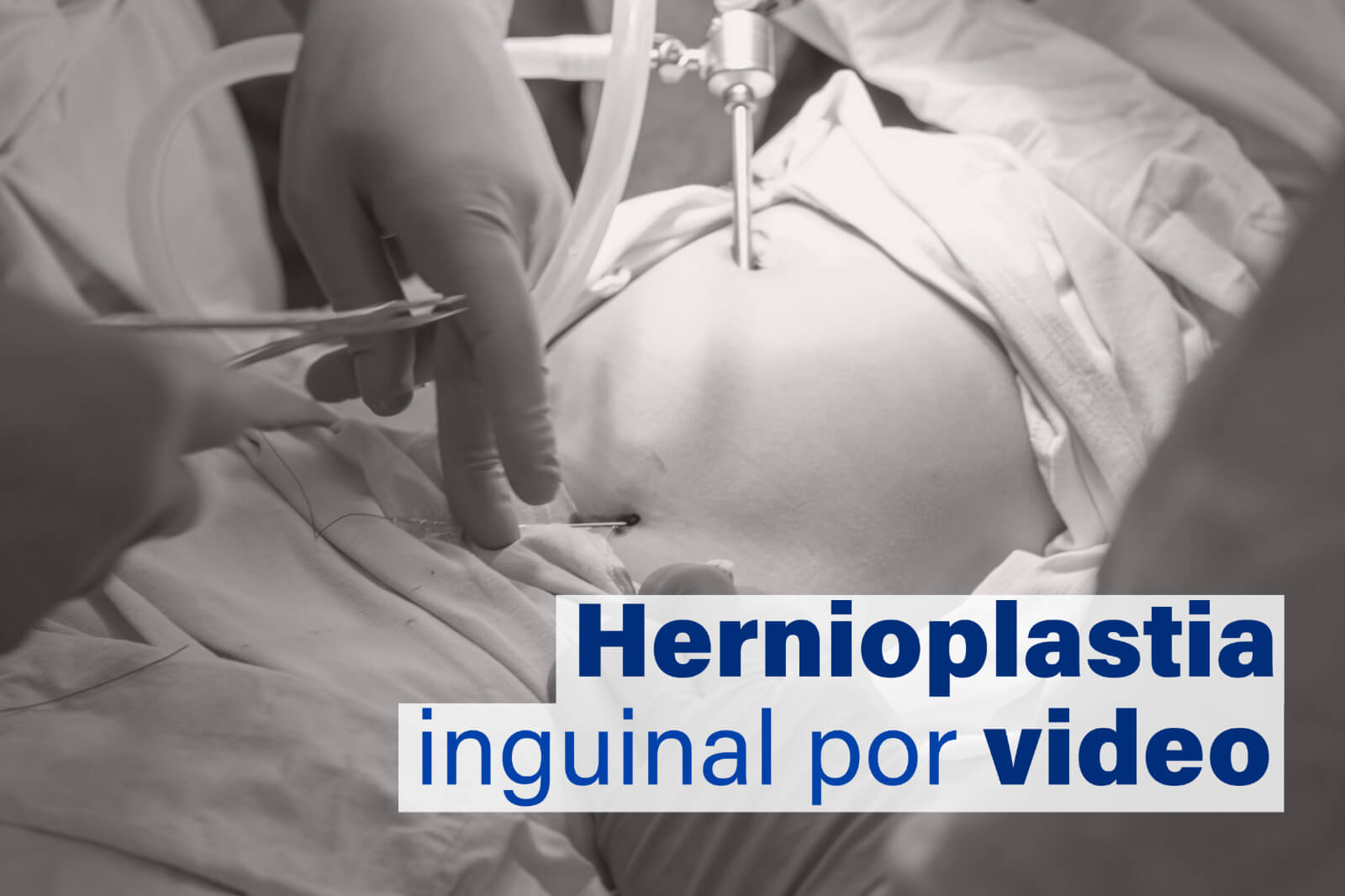 Hernioplastia inguinal por video